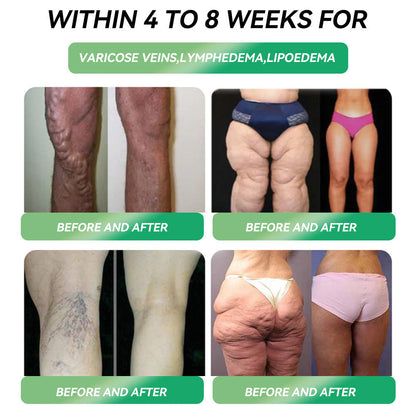 30% OFF👑|𝐋𝙀𝑹𝐂𝗘𝗔® 𝑮𝗟𝐏-𝟭𝑴𝒆𝒕𝒂𝒃𝒐𝒍𝒊𝒄 𝑩𝒂𝒍𝒂𝒏𝒄𝒆 𝑶𝒓𝒂𝒍 𝑨𝒎𝒑𝒐𝒖𝒍𝒆𝒔